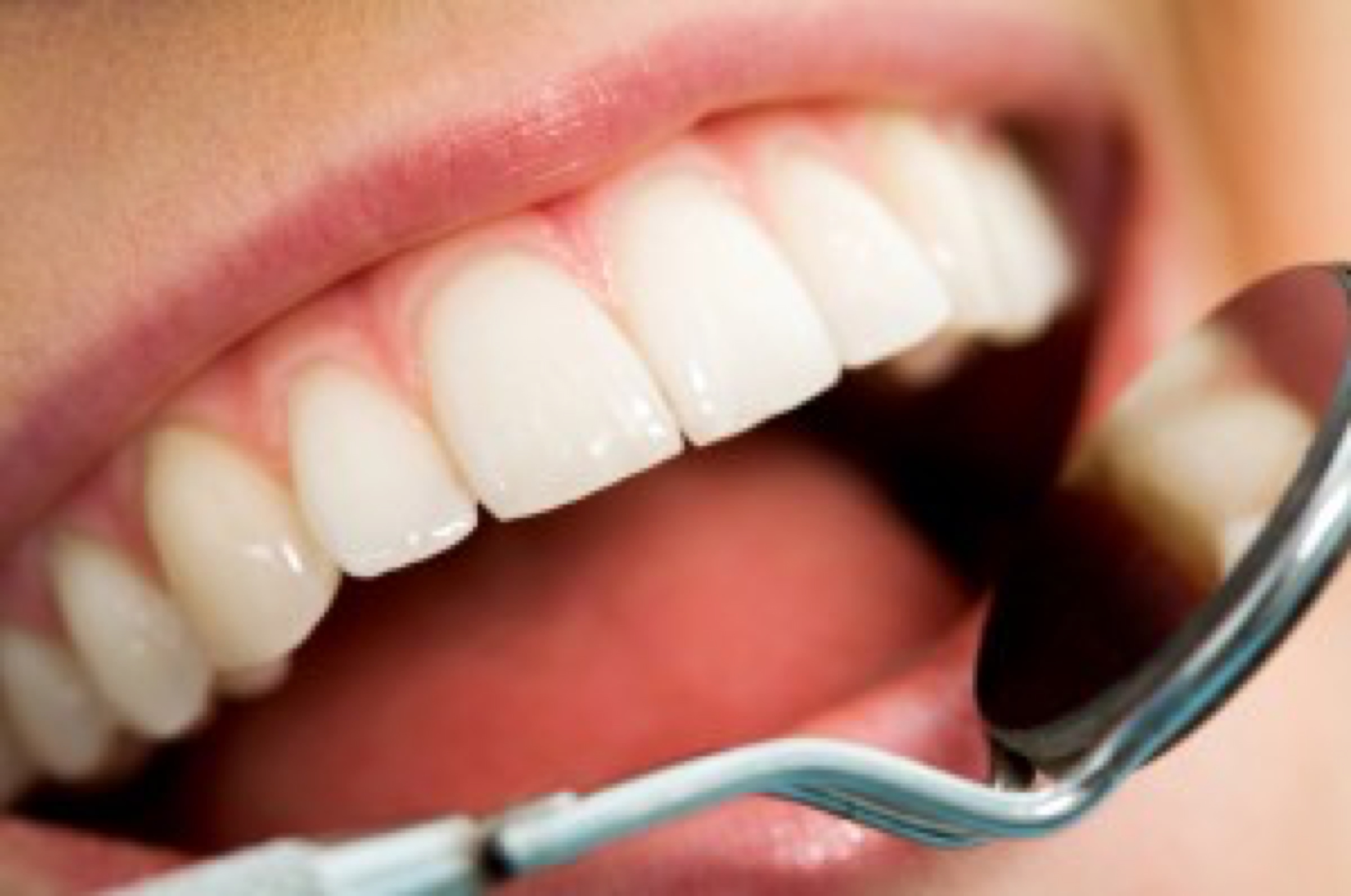 Mouth checkup width=