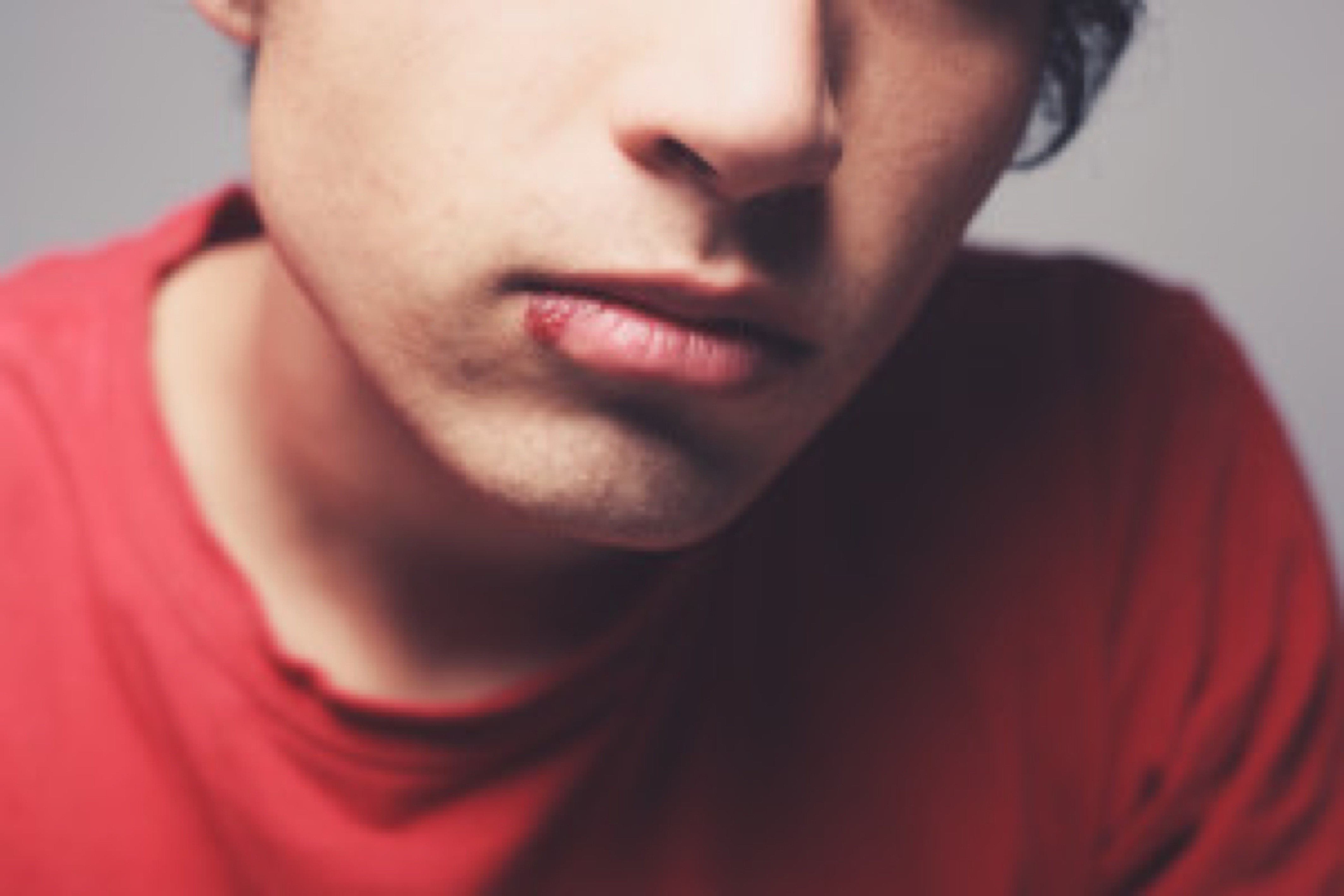 Man with cold sore