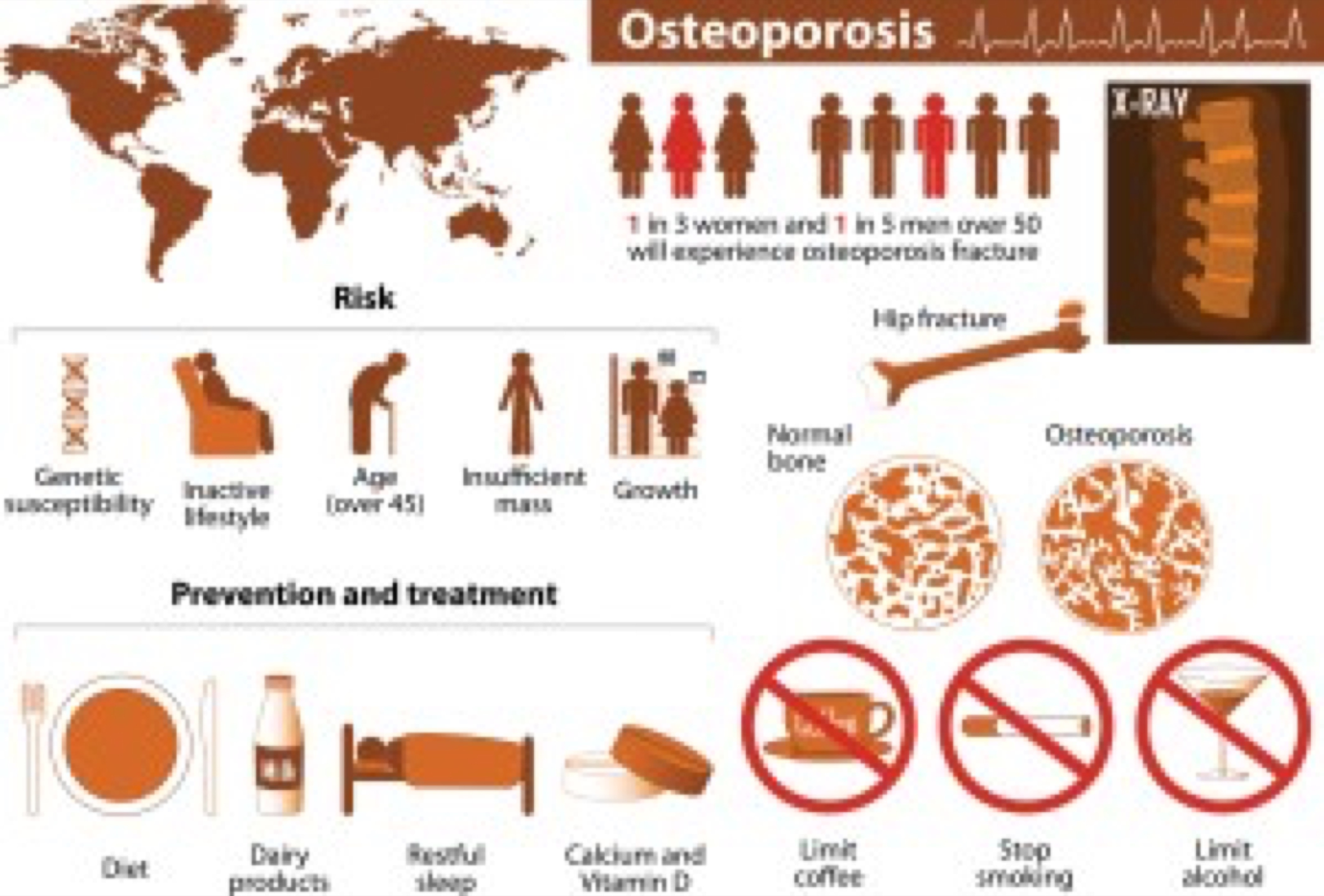 osteoporosis. health problems. medicine in medical infographics. elements and icons for design. concept. illness illustration.